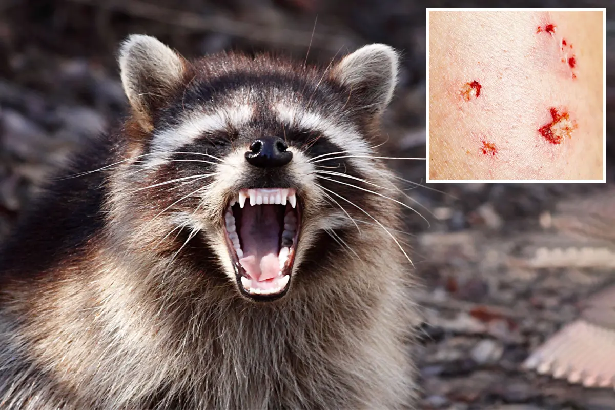 Rabid Raccoon Found in LA