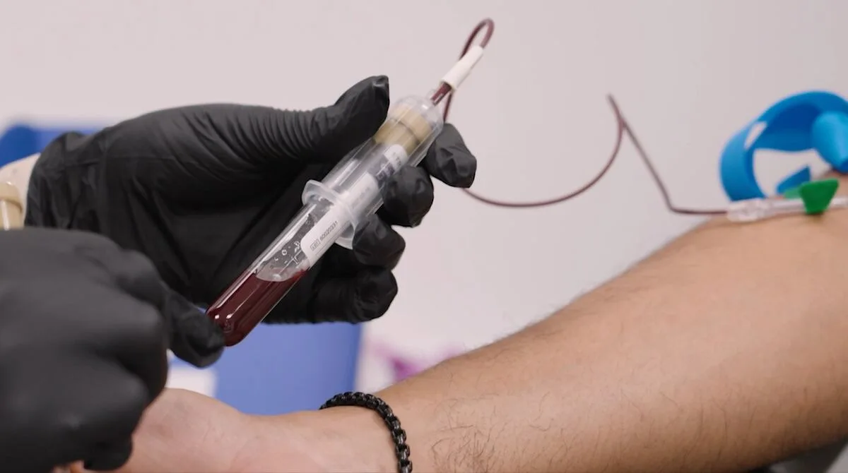 Alzheimer's Blood Test