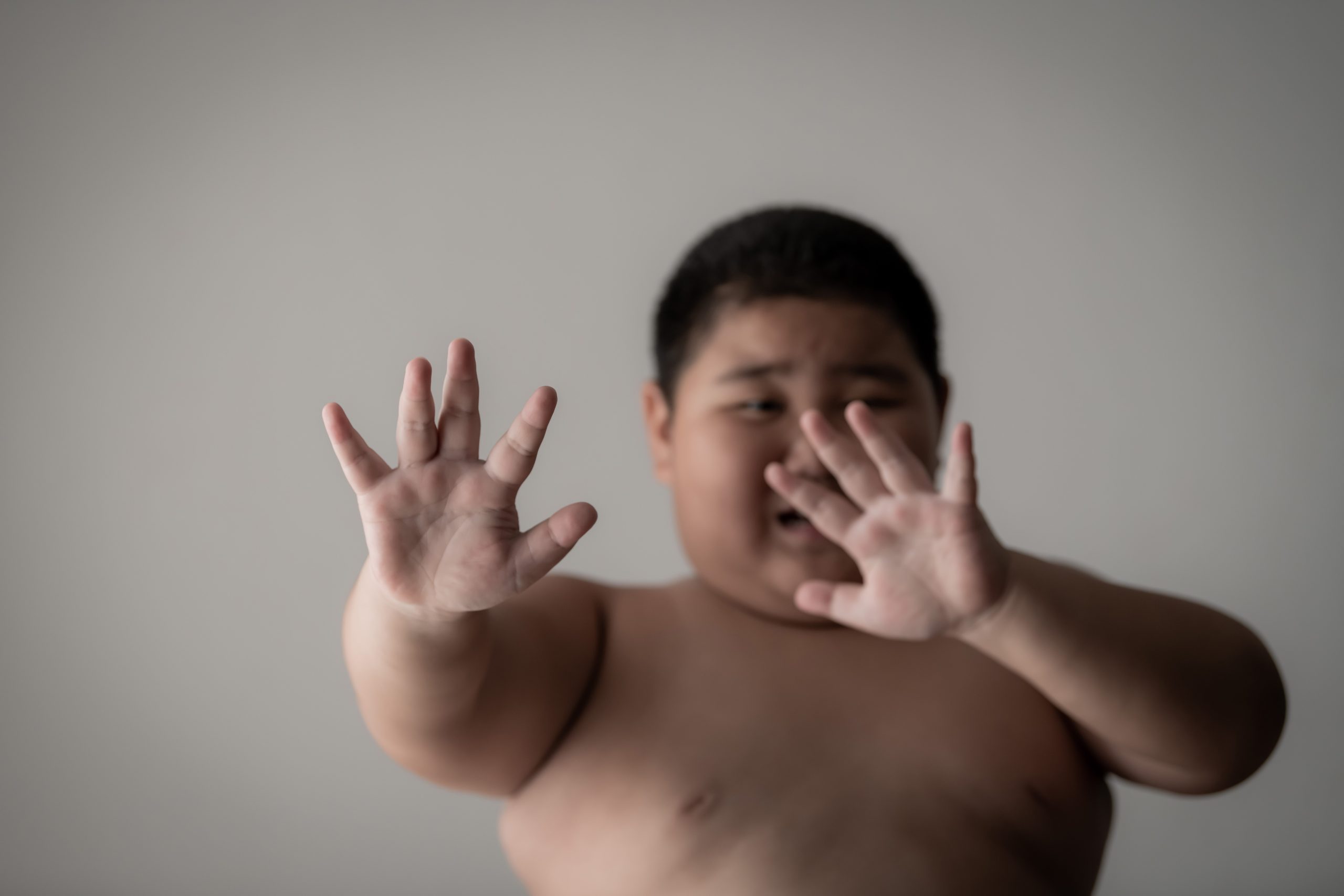 OMS contre l'obésité infantile